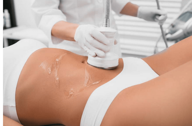 cavitation cellulite