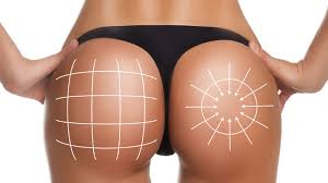 Chirurgie esthétique au Maroc pour avoir des fesses plus grosses