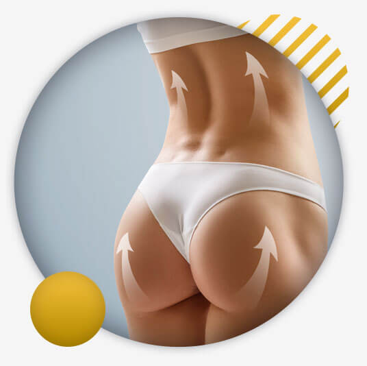 Buttock augmentation in Morocco