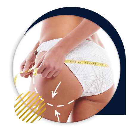 Buttock augmentation in Morocco